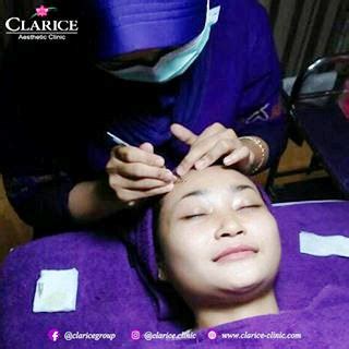 10 Perawatan Wajib di Clarice Aesthetic Clinic: Harganya Mulai 99 Ribu! 10 Perawatan Wajib di Clarice Aesthetic Clinic: Harganya Mulai 99 Ribu!