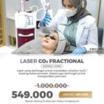 5 Bocoran Harga Laser di Bening's Clinic: Mulai dari RpXXX Aja!