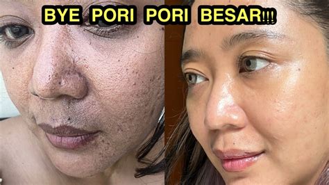 5 Cara Kilat Tutup Pori-Pori: Kulit Mulus Impian! 5 Cara Kilat Tutup Pori-Pori: Kulit Mulus Impian!