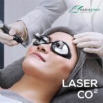 5 Fakta Harga Laser CO2 di Naavagreen 2022: Lebih Murah dari Dugaan!