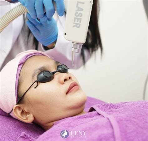 5 Fakta Harga Perawatan Leny Skincare: Ada yang Mulai dari Rp 25.000! 5 Fakta Harga Perawatan Leny Skincare: Ada yang Mulai dari Rp 25.000!