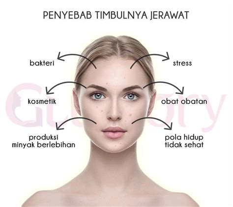5 Rahasia Alami Atasi Wajah Sensitif and Berjerawat! 5 Rahasia Alami Atasi Wajah Sensitif and Berjerawat!