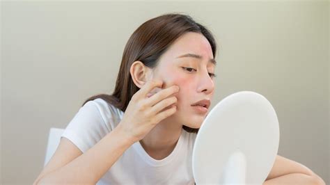5 Rahasia Dewa Wajah Sensitis Untuk Kulit Bebas Iritasi! 5 Rahasia Dewa Wajah Sensitis Untuk Kulit Bebas Iritasi!