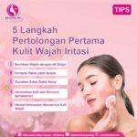5 Rahasia Dewa Wajah Sensitis Untuk Kulit Bebas Iritasi!