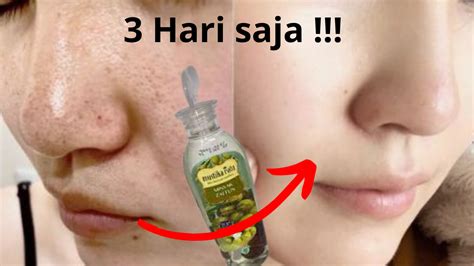 5 Treatment Komedo MENGAKTIFKAN Gluta and SKIN GLOW SPESIALIST Approved! 5 Treatment Komedo MENGAKTIFKAN Gluta and SKIN GLOW SPESIALIST Approved!
