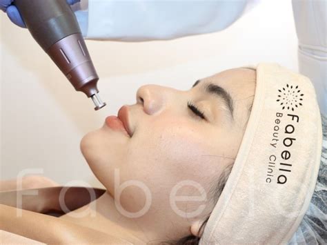 5 Treatment Komedo MENGAKTIFKAN Gluta and SKIN GLOW SPESIALIST Approved! 5 Treatment Komedo MENGAKTIFKAN Gluta and SKIN GLOW SPESIALIST Approved!