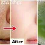 7 Cara Ampuh Mengecilkan Pori-Pori Wajah Secara Alami, Hasilnya Terlihat!