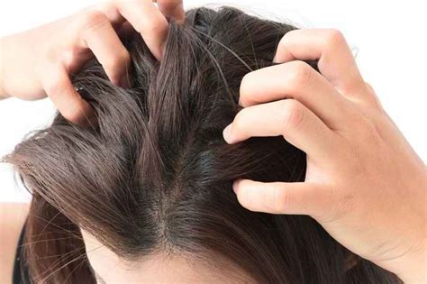 7 Cara Ampuh Menghilangkan Kulit Kepala Gatal yang Bisa Kamu Coba Hari Ini! 7 Cara Ampuh Menghilangkan Kulit Kepala Gatal yang Bisa Kamu Coba Hari Ini!