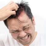 7 Cara Ampuh Menghilangkan Kulit Kepala Gatal yang Bisa Kamu Coba Hari Ini!