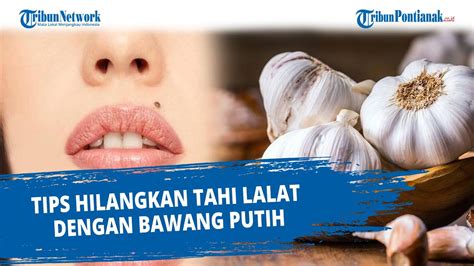7 Cara Ampuh Perawatan Tahi Lalat Alami yang Bisa Kamu Coba di Rumah