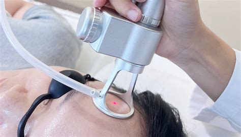 7 Cara Laser Mengecilkan Pori-Pori Wajah secara Instan dan Permanen! 7 Cara Laser Mengecilkan Pori-Pori Wajah secara Instan dan Permanen!
