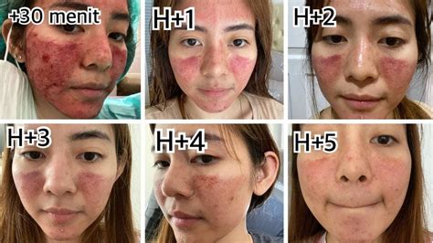 7 Fakta Mengejutkan Harga Dermapen di ERHA: Nomor 5 Bikin Dompet Kaget! 7 Fakta Mengejutkan Harga Dermapen di ERHA: Nomor 5 Bikin Dompet Kaget!