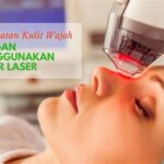 7 Manfaat Laser Wajah yang Belum Kamu Ketahui untuk Mendapatkan Kulit Mulus dan Bebas Jerawat!