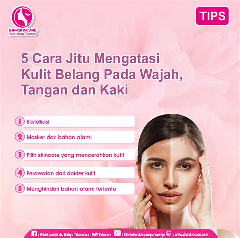 7 Rahasia Ampuh Atasi Wajah Belang dalam Seminggu! 7 Rahasia Ampuh Atasi Wajah Belang dalam Seminggu!