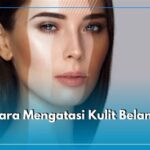 7 Rahasia Ampuh Atasi Wajah Belang dalam Seminggu!