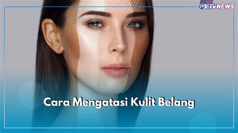7 Rahasia Ampuh Atasi Wajah Belang dalam Seminggu!