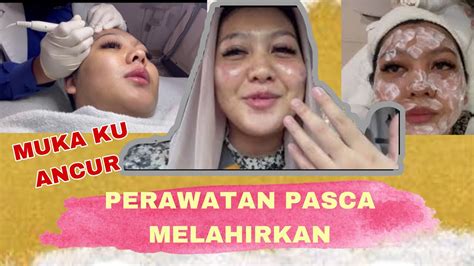 7 Rahasia Cauter Wajah: Tampil Glowing Tanpa Bekas Jerawat! 7 Rahasia Cauter Wajah: Tampil Glowing Tanpa Bekas Jerawat!