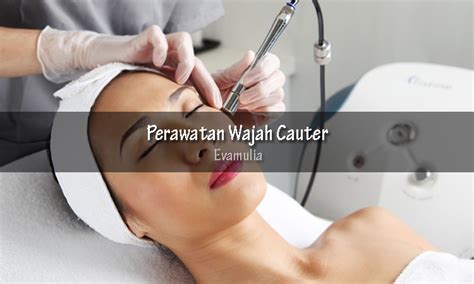 7 Rahasia Cauter Wajah: Tampil Glowing Tanpa Bekas Jerawat! 7 Rahasia Cauter Wajah: Tampil Glowing Tanpa Bekas Jerawat!