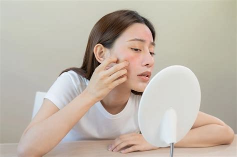 7 Rahasia Kulit Sensitif Bebas Iritasi: Cewek Wajib Tahu! 7 Rahasia Kulit Sensitif Bebas Iritasi: Cewek Wajib Tahu!
