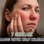 7 Rahasia Merawat Kulit Sensitif: Bye-Bye Kemerahan and Iritasi!