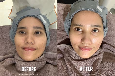 7 Rahasia Perawatan Erha yang Bikin Glowing Ala Artis Korea 7 Rahasia Perawatan Erha yang Bikin Glowing Ala Artis Korea