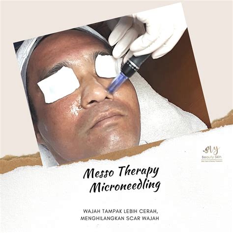 7 Treatment Dermies di Bawah 500 Ribu: Kulit Glowing Gak Perlu Mahal! 7 Treatment Dermies di Bawah 500 Ribu: Kulit Glowing Gak Perlu Mahal!