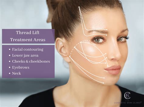 7 Treatment Mengecilkan Pipi Tembem, Langsung Tirus! 7 Treatment Mengecilkan Pipi Tembem, Langsung Tirus!