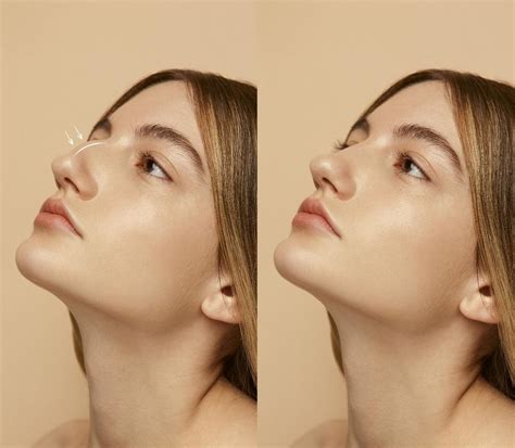 7 Treatment Mengecilkan Pipi Tembem, Langsung Tirus! 7 Treatment Mengecilkan Pipi Tembem, Langsung Tirus!