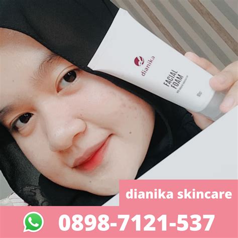 7 Treatment NMW Clinic Harga di Bawah 1 Juta! (Hasilnya Bikin Pangling)