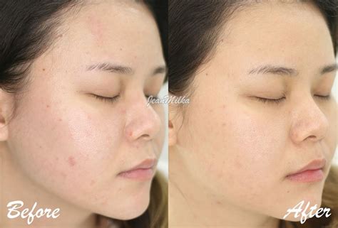 Berapa Sih Biaya Perawatan di ERHA? Ini Rincian Lengkap 23 Treatment-nya! Berapa Sih Biaya Perawatan di ERHA? Ini Rincian Lengkap 23 Treatment-nya!
