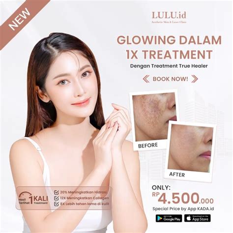 - 😜 Rp50.000 - Glow Up ala Larissa? Begini Kisahnya! 💸