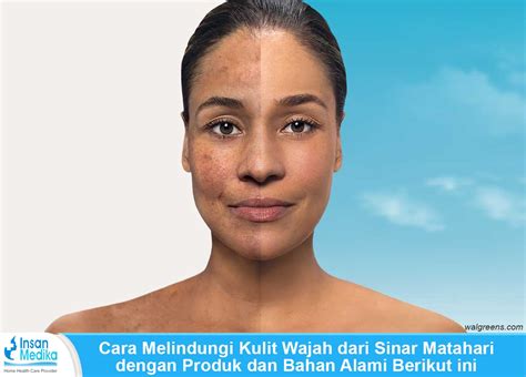 5 Rahasia Glowing Maksimal Setelah Laser Wajah: Wajib Tahu! 5 Rahasia Glowing Maksimal Setelah Laser Wajah: Wajib Tahu!