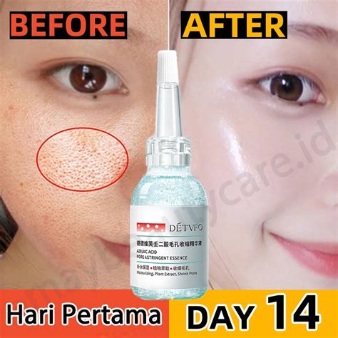 5 Serum Ampuh untuk Pori-Pori Mulus Bak Filter! 5 Serum Ampuh untuk Pori-Pori Mulus Bak Filter!
