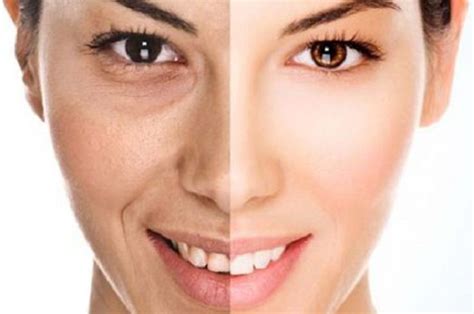 7 Treatment Alami Menghilangkan Kerutan di Wajah yang Bisa Kamu Coba di Rumah! 7 Treatment Alami Menghilangkan Kerutan di Wajah yang Bisa Kamu Coba di Rumah!