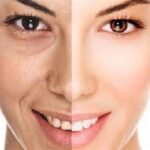 7 Treatment Alami Menghilangkan Kerutan di Wajah yang Bisa Kamu Coba di Rumah!