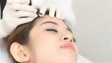 7 Treatment Cauter Wajah untuk Menghilangkan Jerawat dan Menciptakan Kulit Mulus dalam 1 Minggu! 7 Treatment Cauter Wajah untuk Menghilangkan Jerawat dan Menciptakan Kulit Mulus dalam 1 Minggu!