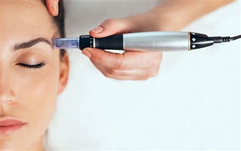 7 Treatment Cauter Wajah untuk Menghilangkan Jerawat dan Menciptakan Kulit Mulus dalam 1 Minggu! 7 Treatment Cauter Wajah untuk Menghilangkan Jerawat dan Menciptakan Kulit Mulus dalam 1 Minggu!